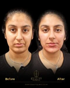 Female Model Geometric Harmony
