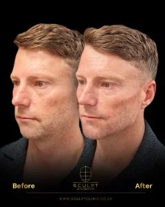Male Model Before and After