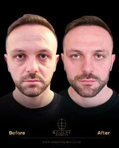 Male Model Facial Proportions