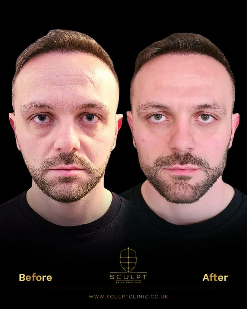 Male Model Facial Proportions