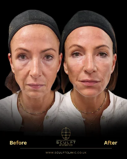 The Signature Structural Rejuvenation Package Before & After
