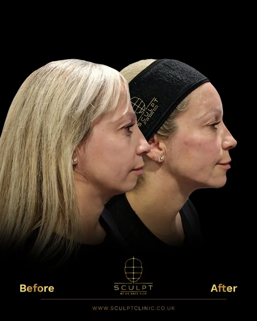 Female Facial Attractiveness