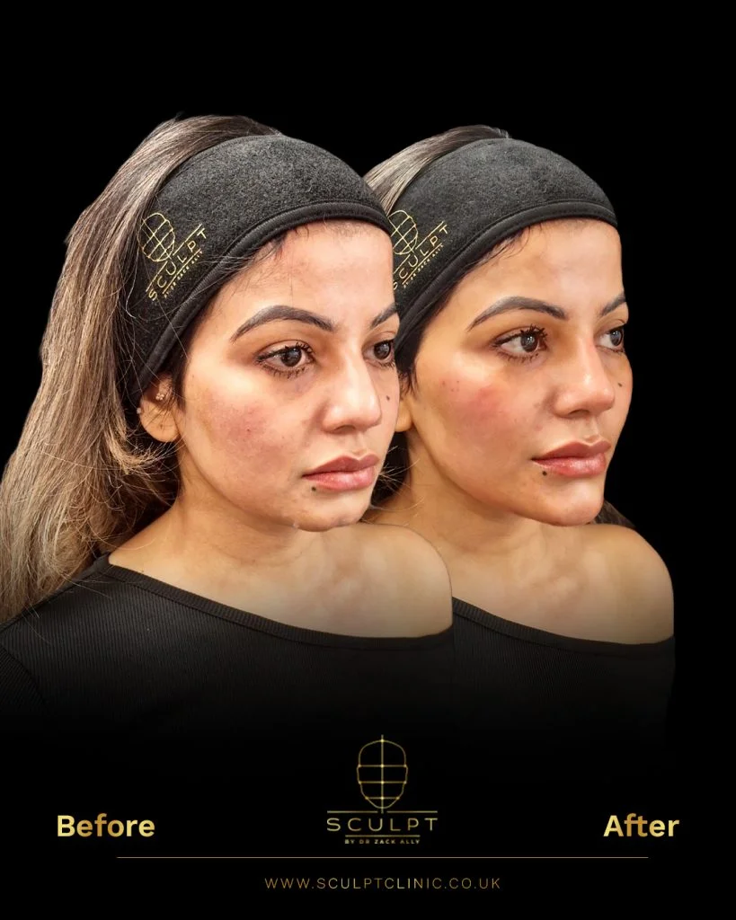 Female Maximising Facial Attractiveness