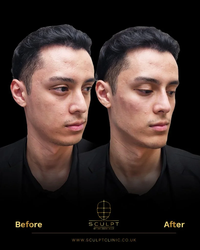 Male Facial Attractiveness