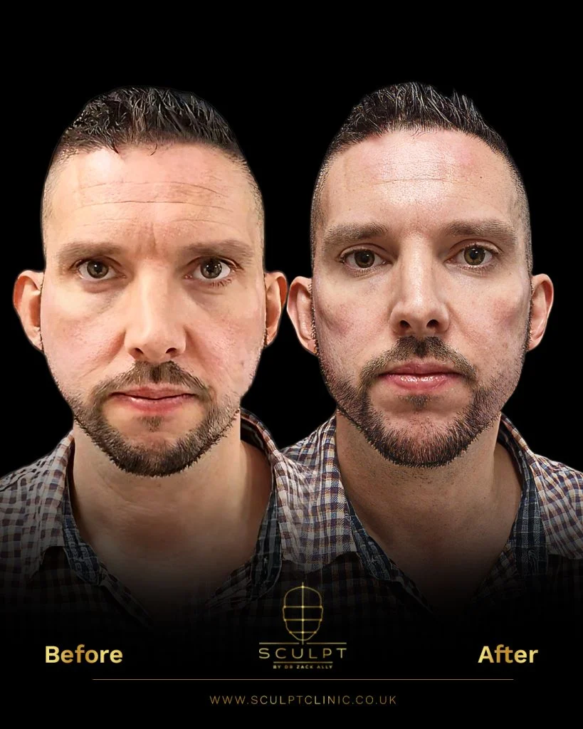 Male Maximising Facial Attractiveness